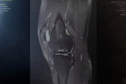 X-ray of a knee